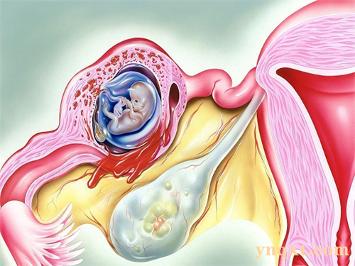 什么是供卵试管受孕？